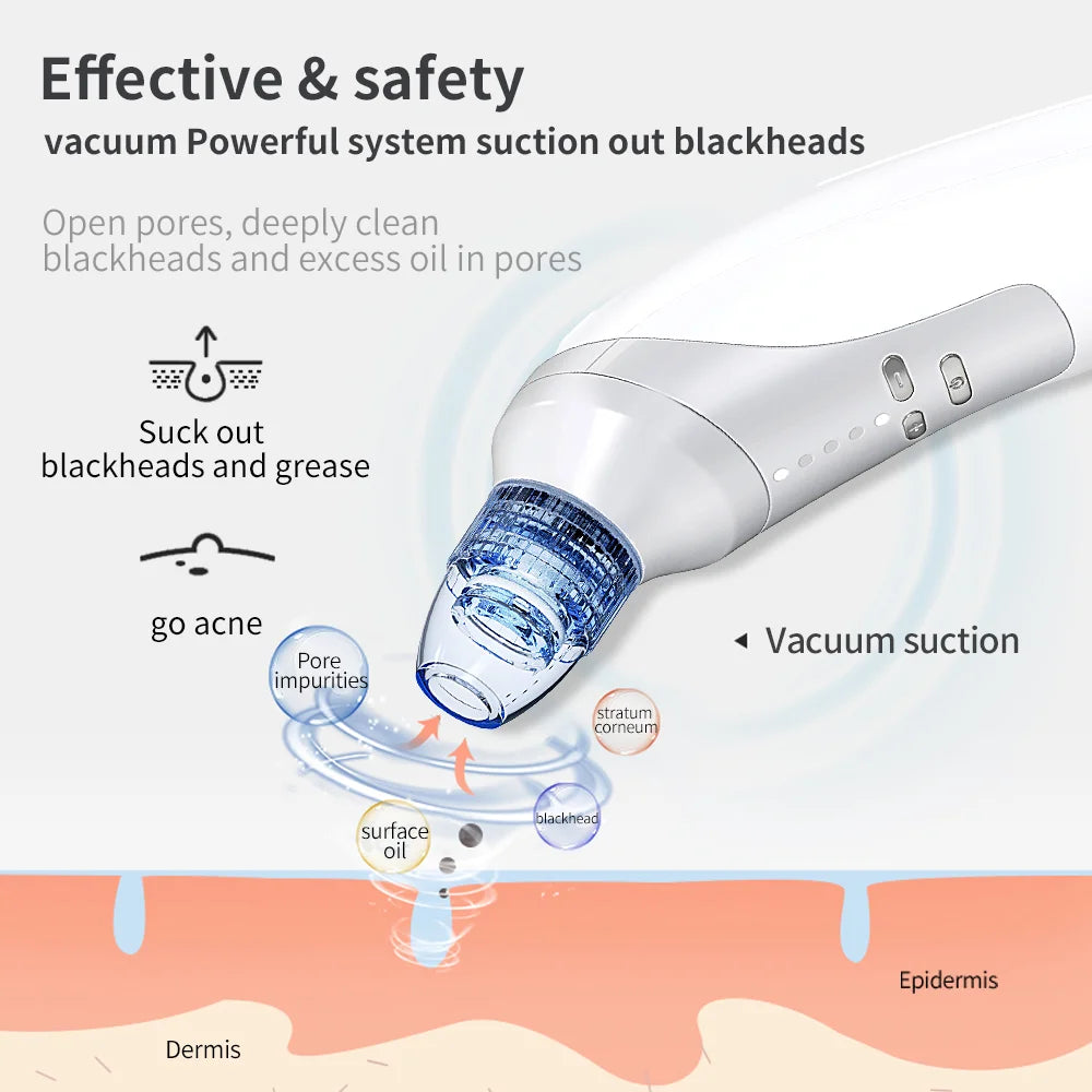 Eletric Skin Cleanser Water Oxygen Vacuum Facial Pore Skin Care Blackheads Remove 4 heads Deep Cleaning Tools