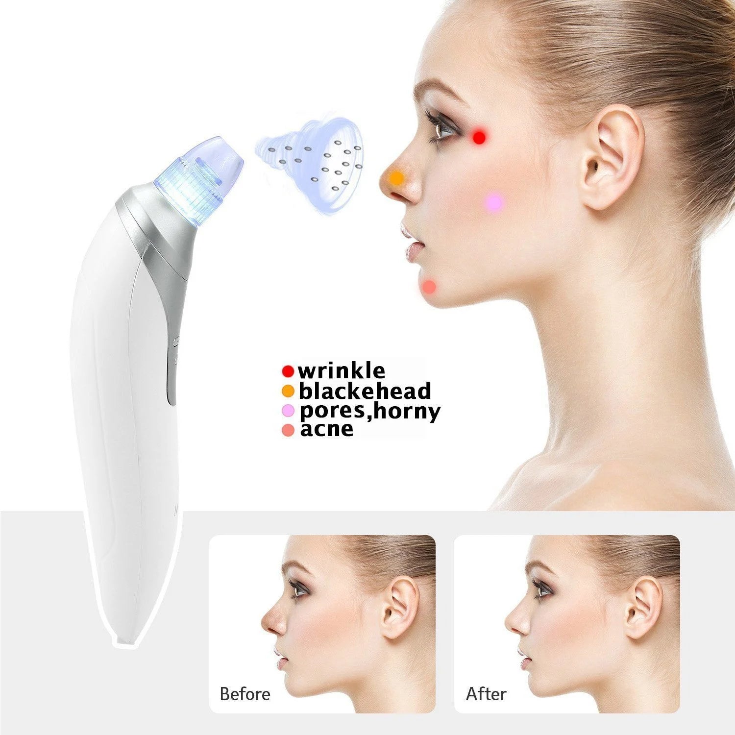 Eletric Skin Cleanser Water Oxygen Vacuum Facial Pore Skin Care Blackheads Remove 4 heads Deep Cleaning Tools